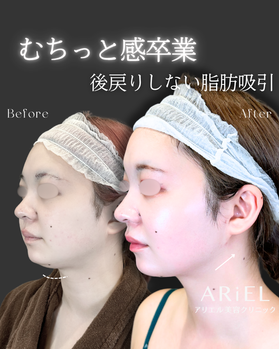 No.9143の症例写真